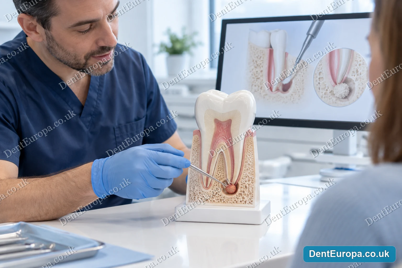 Apical resection treatment explanation at DentEuropa in Hounslow