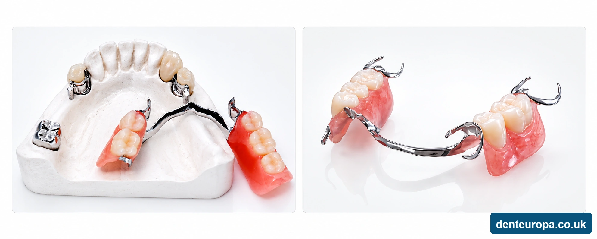 Comparison of a precision attachment denture and a conventional clasp denture