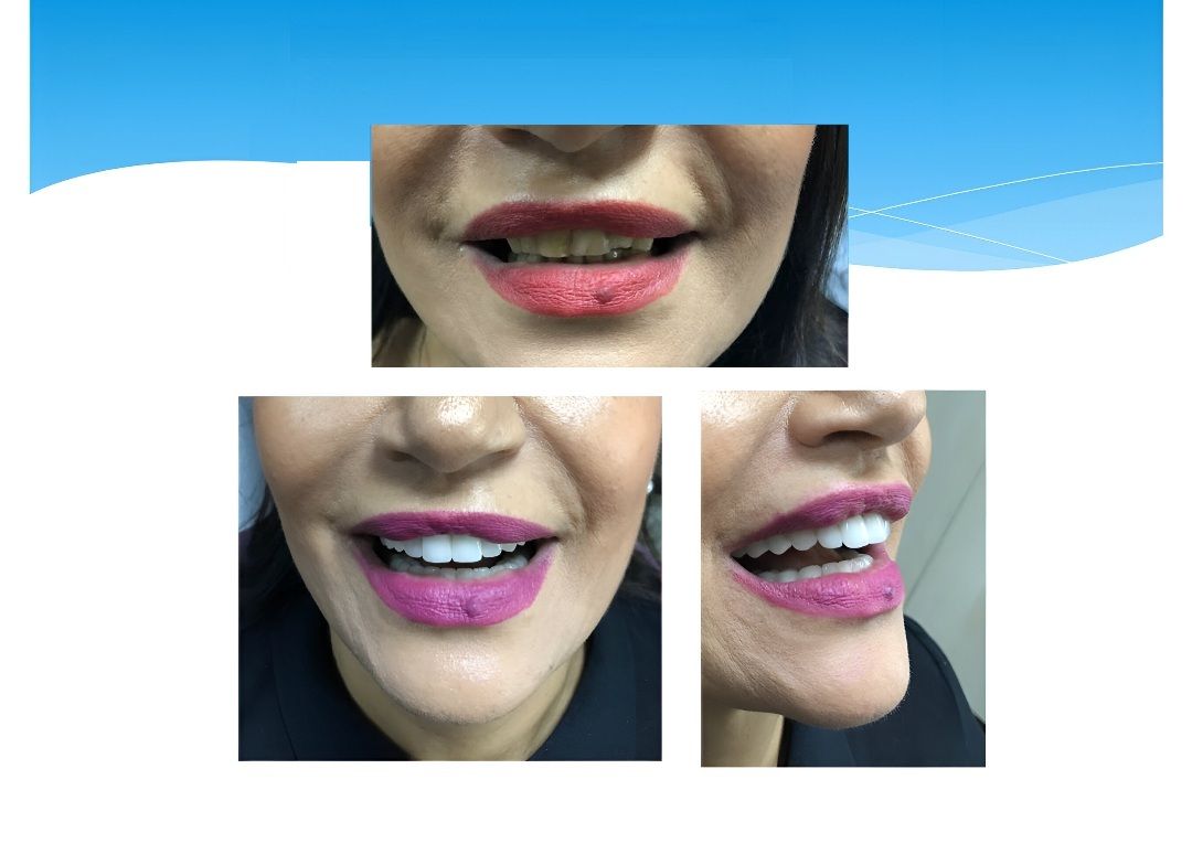 Before and After Treatment  