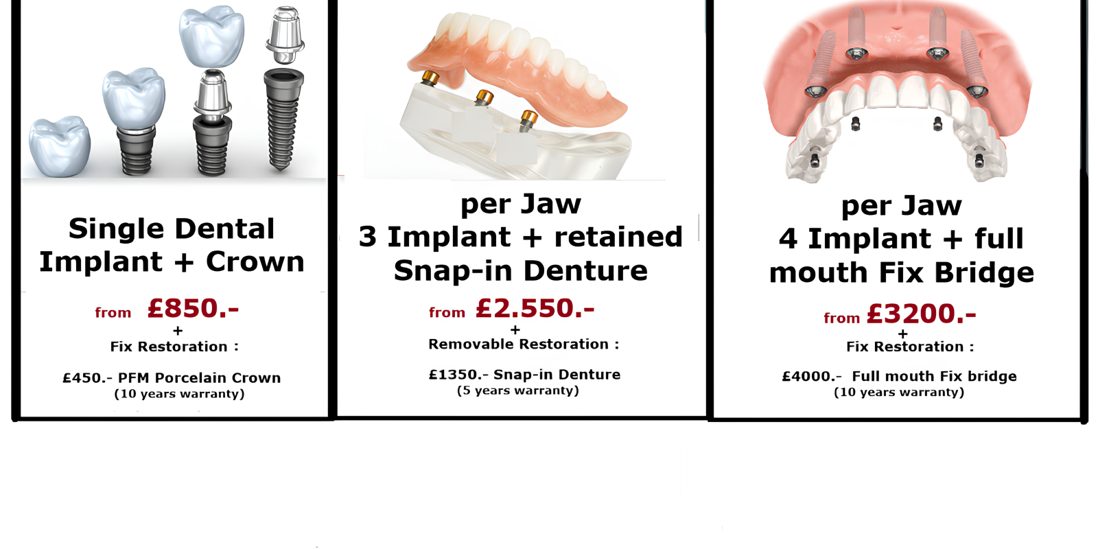 Implant treatment options